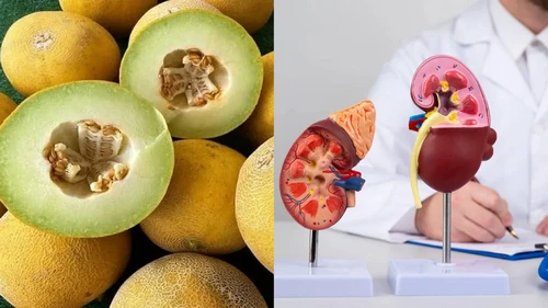 خربزه برای سنگ کلیه